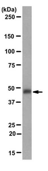 Anti-Calreticulin Antibody, clone 16B11.1 | MABT217